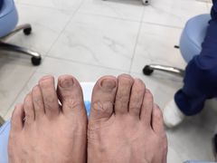 -Andrew指甲专科灰指甲·甲沟炎矫正·3D步态矫形鞋垫定制(浦三路店)