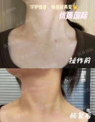 -木北造型