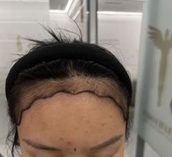 点击看大图 -熙朵美学植发·连锁品牌