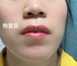 -西施无菌半永久纹绣眉眼影唇轻增发纹发际线