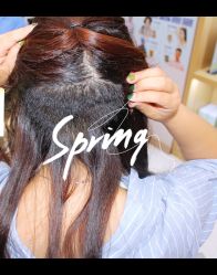 体验后-大麦微针植发全国连锁