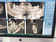 -Dr.Z dental仁康种植矫正中心