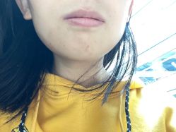 -成都西区医院整形美容