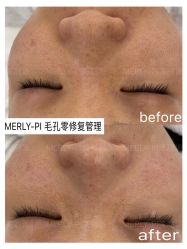 -MLP美丽派·问题肌疗愈中心