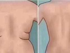 -天姿美容·美体科技SPA·艾姿美店