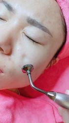 -成都苗方清颜专业祛痘