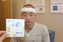 -大麦微针植发丨全国连锁