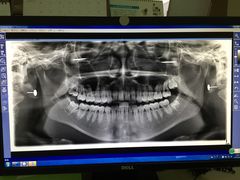 -天使口腔门诊部(上海店)