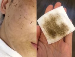 -美肤盾祛痘·问题肌头疗管理中心