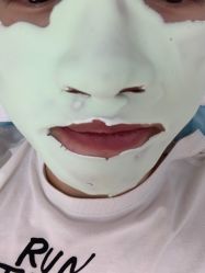 -蕾特恩专业祛痘国际连锁