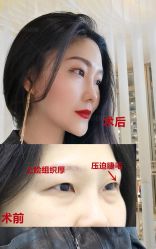 -丰联丽格医疗美容·联合丽格眼整形中心