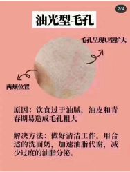 -美肤盾祛痘·问题肌头疗管理中心