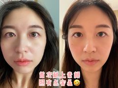 -FACE·日本小颜美容整骨(福田店)