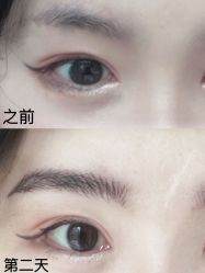 点击看大图 -OnFaer.纹眉半永久无创洗眉
