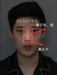 -北京米扬丽格医疗美容·联合丽格鼻整形中心