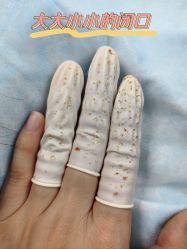 体验后-宜肤清颜专业祛痘问题肌修护
