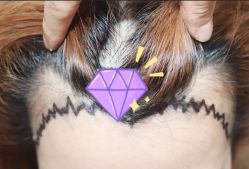 -大麦微针植发全国连锁