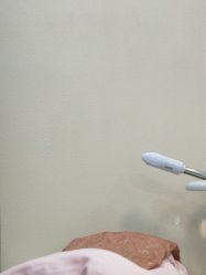 -清颜专业祛痘连锁店