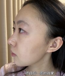 -杭州米兰柏羽医疗美容医院