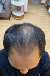 -发饰美男士增发补发假发定制店