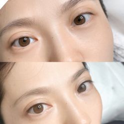 点击看大图 -杨益美学·野生眉半永久纹眉发际线
