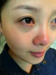 点击看大图 -美莱医学美容医院