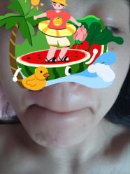 体验后-西安现代妇产医院医疗美容