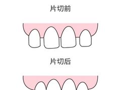 -团圆口腔·种植中心(锦江院区)