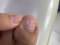 -新甲连锁灰指甲·甲沟炎·鸡眼(黑龙江路店)