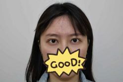 -天津健丽·去眼袋医疗美容机构