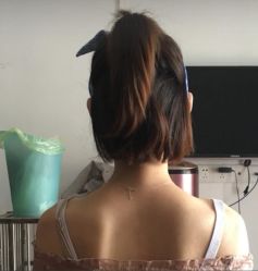 -深圳悦她医疗美容