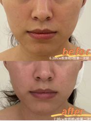 -明潪Selfology升维护理中心