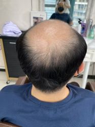 -唐风采假发补发定制