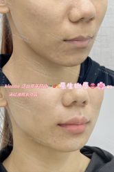 -深圳艺星医疗美容医院