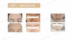 -HEYAN荷妍专业脱毛连锁机构