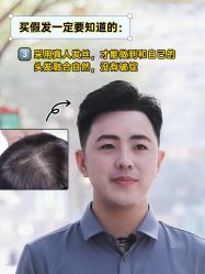 -唐风采假发补发定制