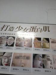 -瑶芳清颜专业祛痘