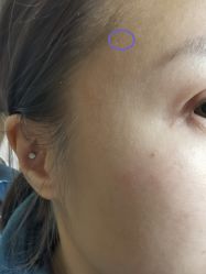 -正璞医疗美容·皮肤修复·微整注射