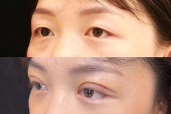 -Yestar 嘉兴艺星医疗美容医院