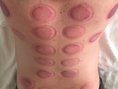 -1号足道推拿会馆