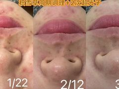 -上置·美兰优湖