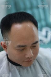 -发饰美男士增发补发假发定制店