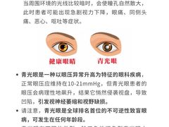 -西安普瑞眼科医院·近视手术·视力防控