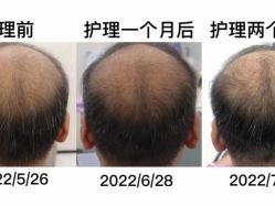 -天其美科学美肤·生发健康管理