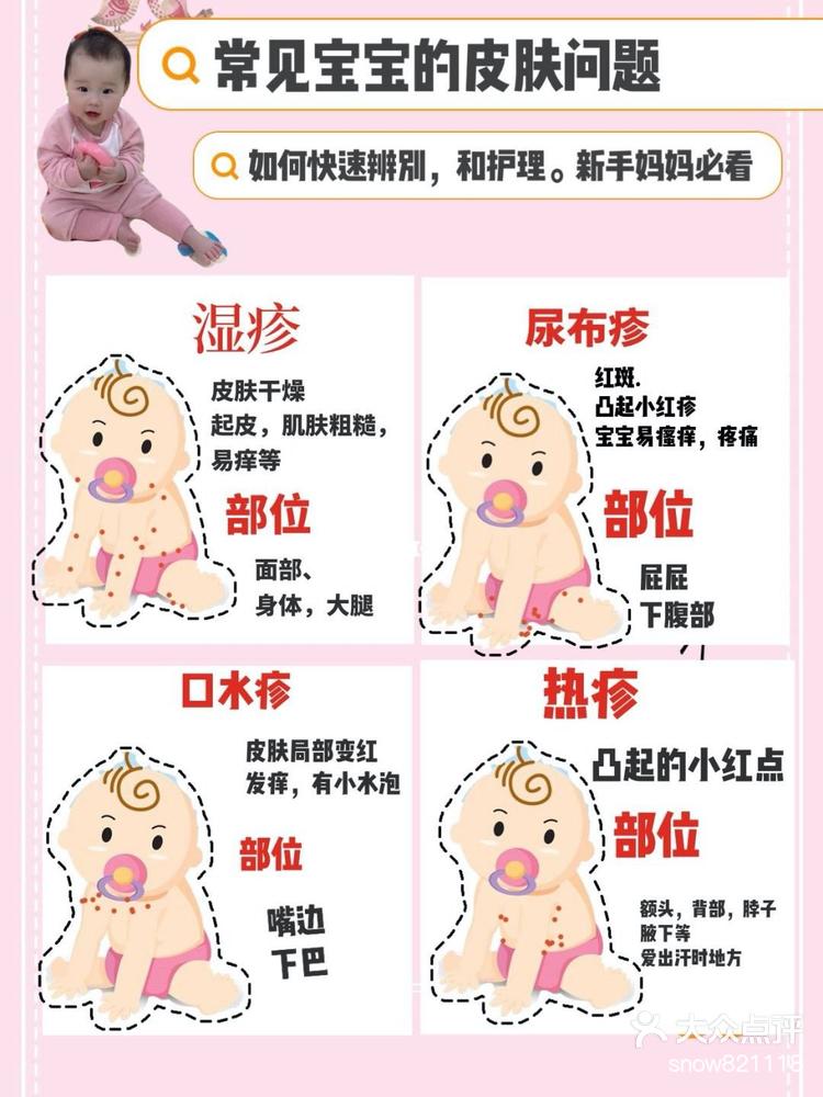 婴儿汗疹子图片图片