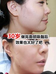 -上海漾颜医疗美容