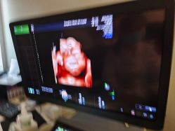 -郑州万安妇产医院