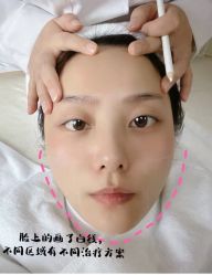 -洁铭新加坡医美