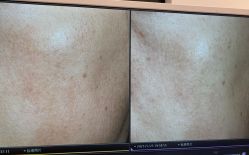 -苑苑vbeauty科技美容SPA