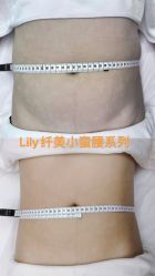 -Lily纤美·科技减脂中心